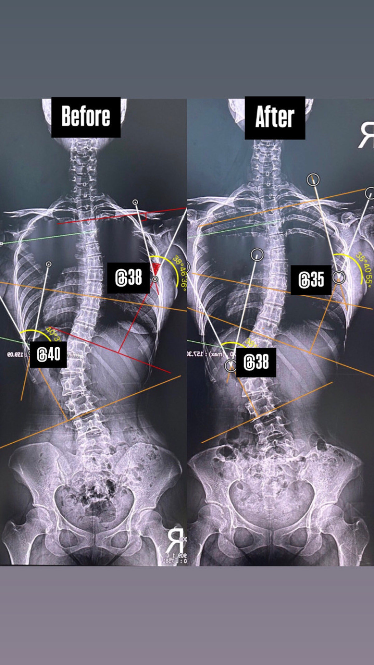 코코필라테스 송천점 사진 3