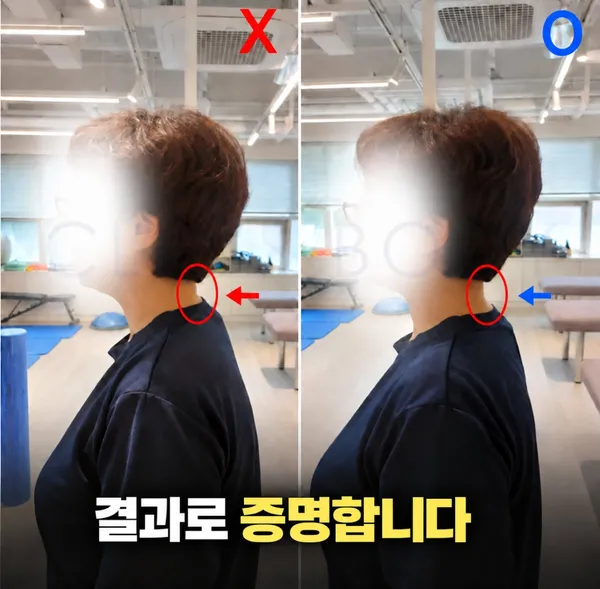 클래스바디 체형교정센터 송파잠실점 사진 2