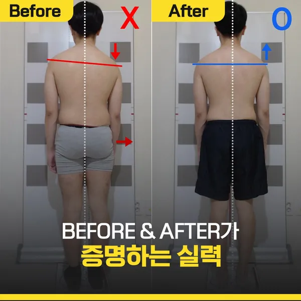 클래스바디 체형교정센터 송파잠실점 사진 4