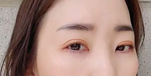 압구정비앤미의원 사진 5