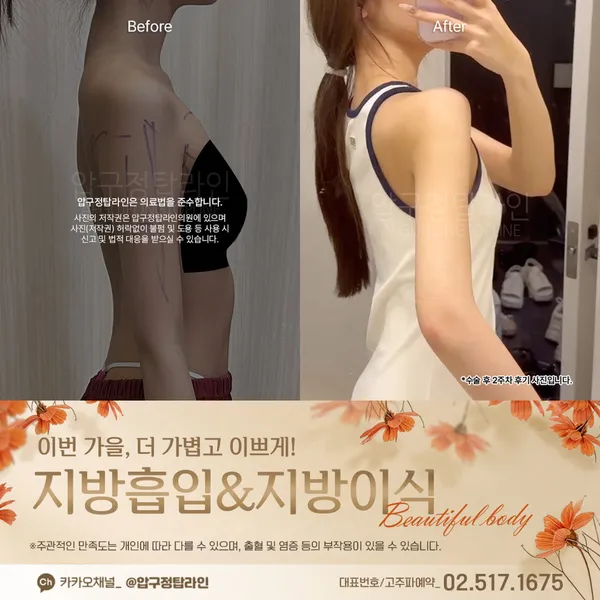 압구정탑라인의원 사진 2