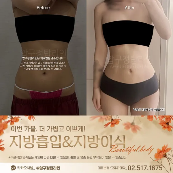 압구정탑라인의원 사진 3