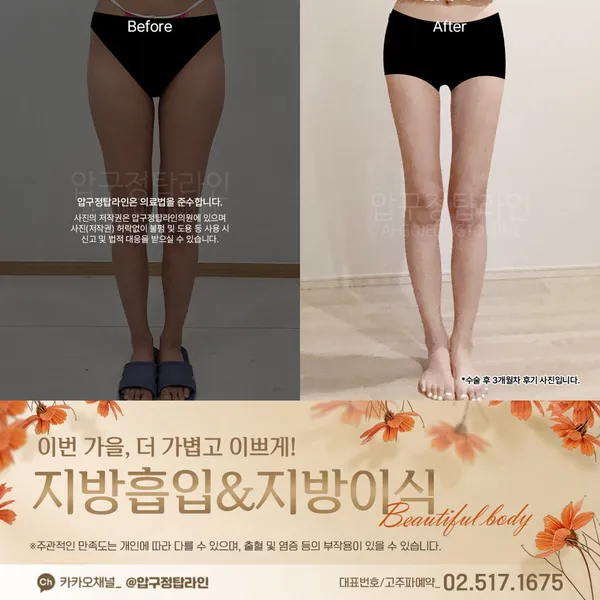 압구정탑라인의원 사진 4