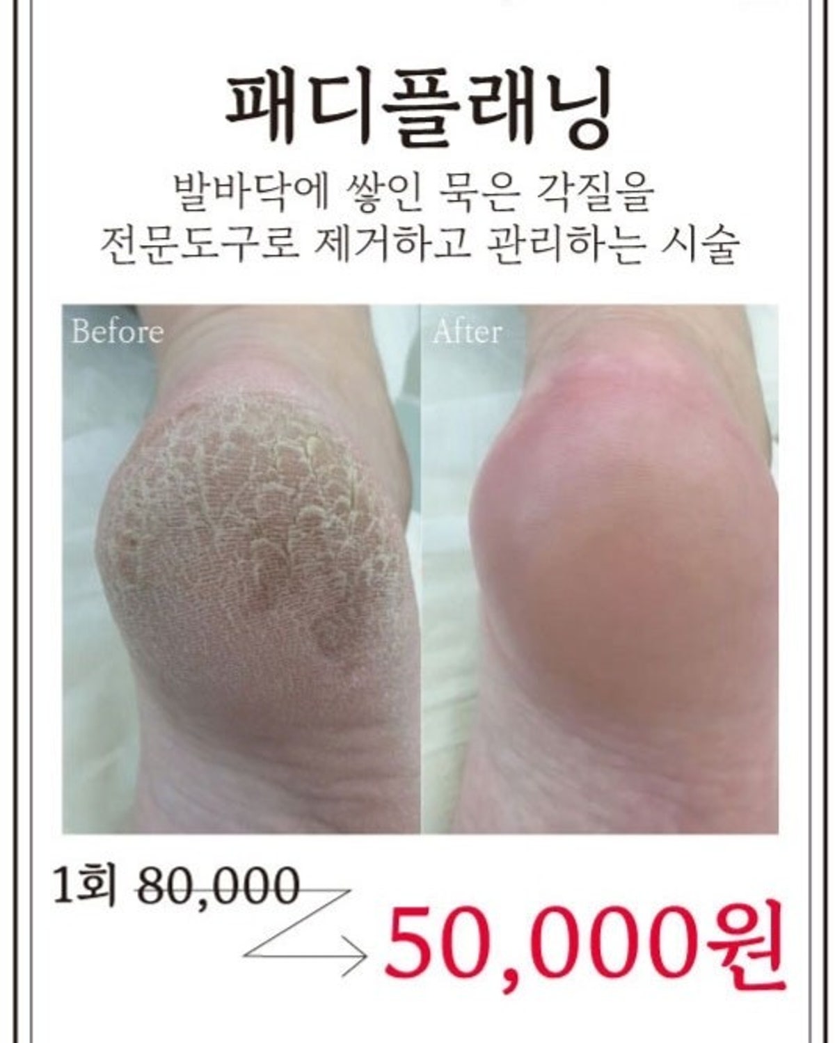 민낯뷰티정관 사진 4