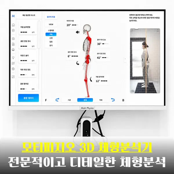 바디밸런스 분당수내 체형교정&PT 사진 3