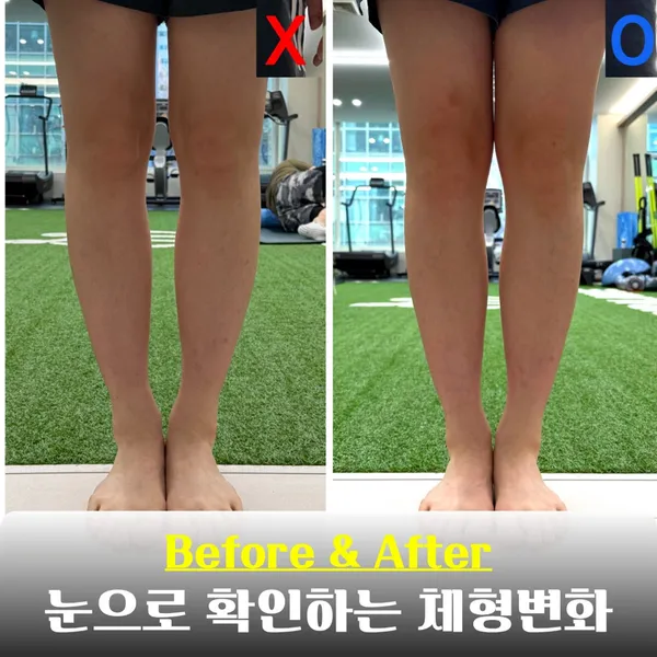 바디밸런스 분당수내 체형교정&PT 사진 4