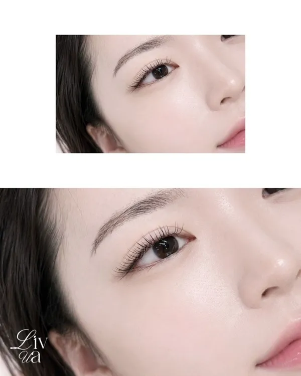 리브유아 사진 3