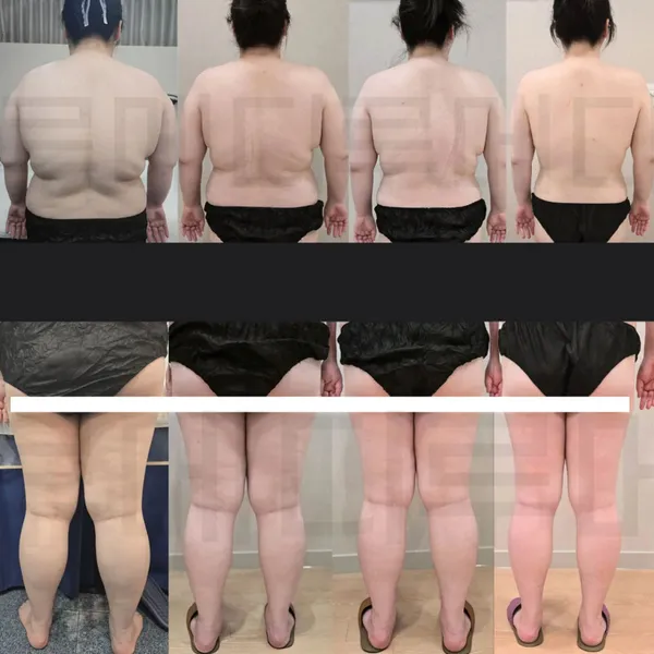 루메디