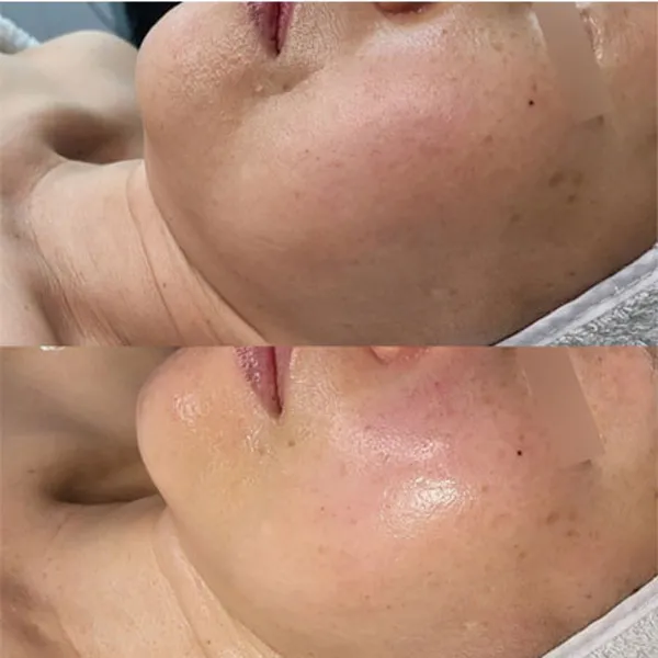 루메디 사진 4