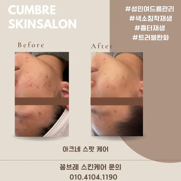 꼼브레 스킨살롱 사진 5