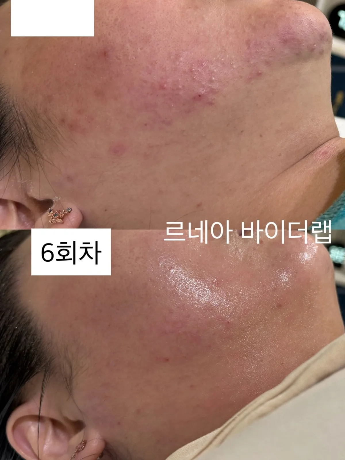 르네아 바이더랩 창원상남점