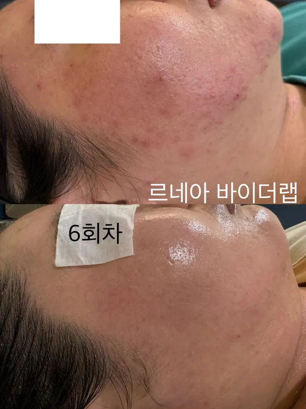 르네아 바이더랩 창원상남점 사진 5